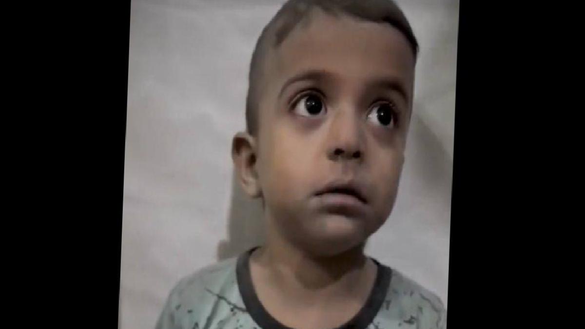 Gazzeli o minik çocuğun son durumu, Dünyadan Haberler