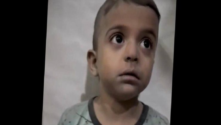 Gazzeli o minik çocuğun son durumu, Dünyadan Haberler