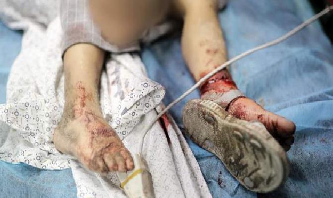 Gazze&#8217;ye taarruz Hiroşima&#8217;ya atılan atom bombasına eşdeğer!, Dünyadan Haberler